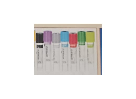EDTA and Citrate Tubes